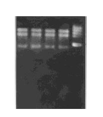 dak) - 70 5 6 d XL U ltrascan, [ 9 117 ],, GP, IgG ( ) (A P), A P, 118, t 2 211, 3,, 212 RNA RNA, 114%, 28S 18S 5S rrna (F ig 1) A 260gA 280 119 212 RNA 213 GPA N IDDM RNA, GPA cdna Β2, N o rthern, N