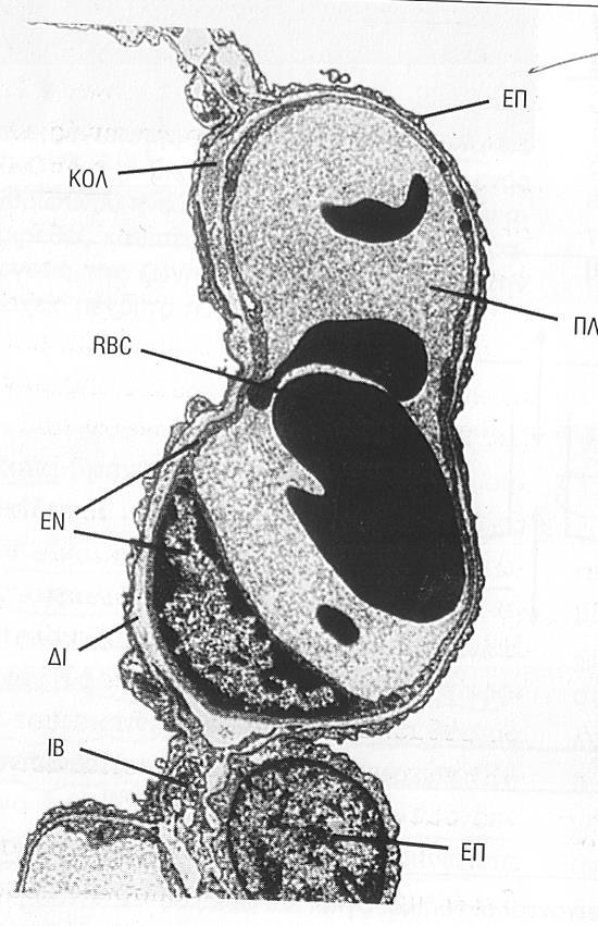 Φυσιολογία άσκηση :Kυψελιδοτριχοειδική μεμβράνη 3 στρώματα : -Το κυψελιδικό επιθήλιο (EΠ) - Το τριχοειδικό ενδοθήλιο (ΕΝ) - διάμεσος ιστός (ΔΙ) Πάχος 0.2-0.