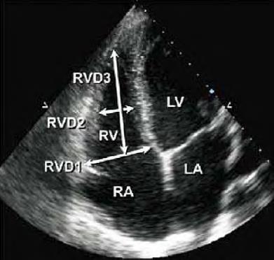 Echocardiogr 2015)