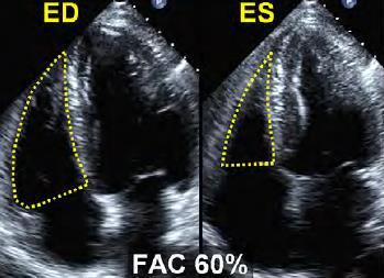 , Eur J Echocardiogr 2006)