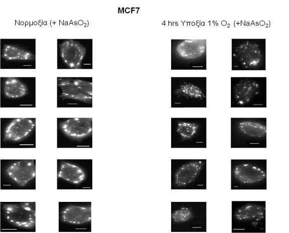 Εικόνα 34: Οπτικά πεδία κυττάρων μαστού ΜCF7 που επωάστηκαν με NaAsO 2 σε