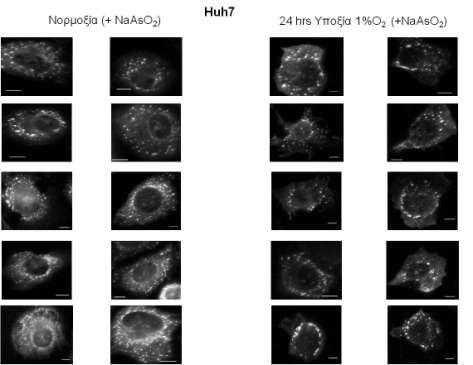 Εικόνα 38: Οπτικά πεδία ηπατικών καρκινικών κυττάρων Ηuh7 που επωάστηκαν με NaAsO 2 σε συνθήκες νορμοξίας ή 24 ωρών υποξίας. Κλίμακα εικόνων (scale bar): 10 μm.