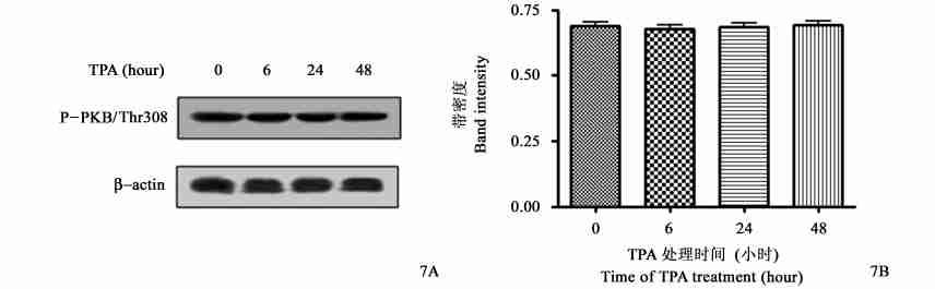 PKB, TPA 6 TPA BGC2823 PKB Ser473 A1 ; B1 Fig. 6 Effect of TPA on the phosphorylation of PKBΠSer473 in gastric cancer BGC2823 cells.