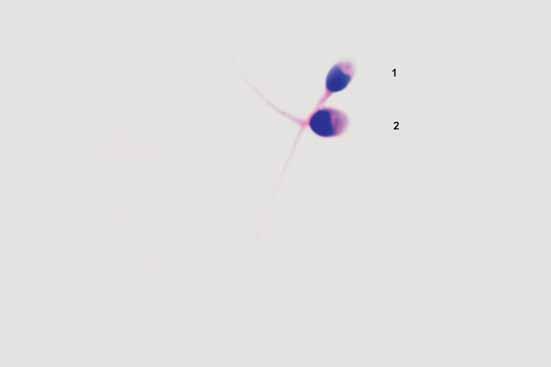 1-Α φυσιολογικά σπερματοζωάρια Εικονογραφημένος Άτλας της Μορφολογίας των Σπερματοζωαρίων 57 Φυσιολογικά σπερματοζωάρια Εικόνα 7.