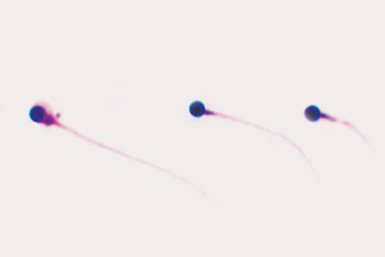 2-Α: Ανωμαλίες της κεφαλής Εικονογραφημένος Άτλας της Μορφολογίας των Σπερματοζωαρίων 63 Σπερματοζωάρια με στρογγυλή κεφαλή Εικόνα 7.