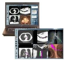 Spiral CT with thin cuts, usually about 1mm CT-Scan DICOM CD ENB:
