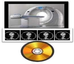 computer and a virtual bronchoscopy of the airways is created.