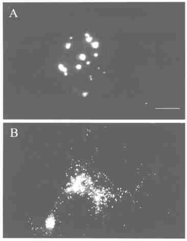 284 21 Fig 1 Immunofluorescent staining of Myc/ PEX to demonstrate the localization of expressed PEX in transfected COS27 cells (A) MycPEXΠpcDNA3 ; (B) rghpex/ pcdna3 Bar :20 m Fig 2 Western blot