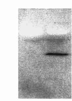 2 : 285 Fig 4 Western blot result of (Myc) nπprghsecmychis transfected COS27 culture medium probed with 9E10 Myc antibody Fifteen microliters of culture supernatants were loaded in each lane 1