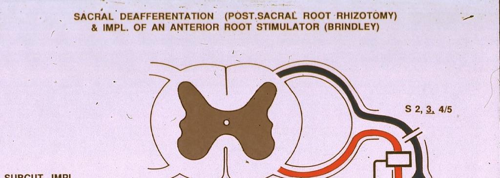 root