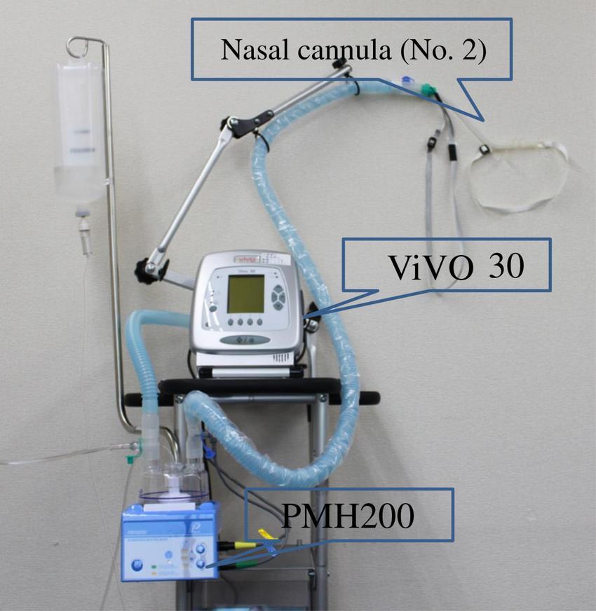 Transnasal Humidified Rapid-Insufflation Ventilatory Exchange (Θερμό Υγροποιημένο Ο2 υψηλής ροής (30 70 lt/min)) παρατείνει χρόνο άπνοιας καλύτερη ανταλλαγή αερίων σε σχέση με τεχνικές