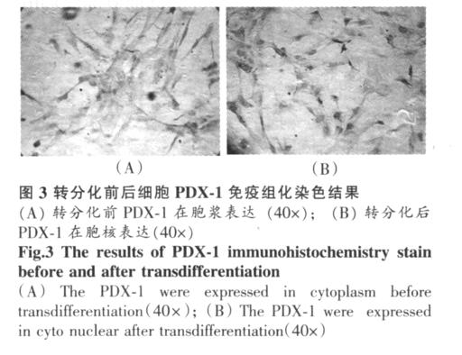 serumfree DMEM/F12 medium 23 PDX-1 3 3 2 3 PDX-1 2 (40 ) () PDX-1 (40 ); () Fig2 ells positive for dithzthone staining(40 ) PDX-1 (40 ) Fig3 The results of PDX-1 immunohistochemistry
