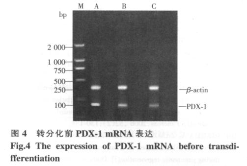 1 : PDX-1 53 2 PDX-1 mrn Table 2 The comparison of surface density of PDX-1 expression before transdifferentiation in,, group 5 M Group n Surface density x ± s bp 0233 1 ± 00157 0114 3 ± 0021 5 5