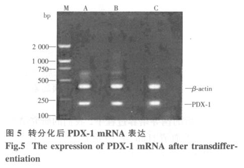 transdifferentiation in, PDX-1 mrn, group Group RT-PR 2% n Optical density x ± s 0~250 bp 4 0782 8 ± 0134 1 0758 3 ± 0147 7 PDX-1 mrn 0745 8 ± 0150 9 4 Notes P > 005 M bp 2 000 1 000 Notes P < 005