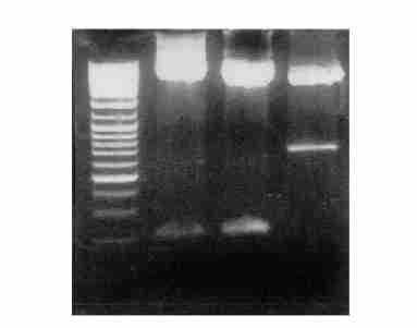 536 20 1 5 p GEX24T212hMT23 p GEX24T212Rab3a BL21, [8,13 ] 50 ml PBS,, Triton X2100 1 %, 30 min,4 (15 000 rπmin,15 min) 2Sepharose 4B,,20 PBS,, [ 3 mg 2 ml 50 mmolπl Tris2HCl (ph 810), 015 l 2 ],25