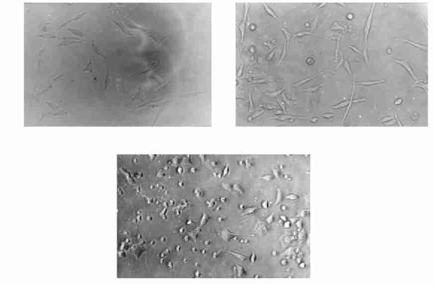 4 : G Rab3a ( GIF) 537 Fig 3 Growth results of the PC12 cells transfected with Rab3a and hmt23 genes (A) Growth of PC12 cells tranfected with pflag2hmt23 ; (B) Growth of PC12 cells cotranfected with
