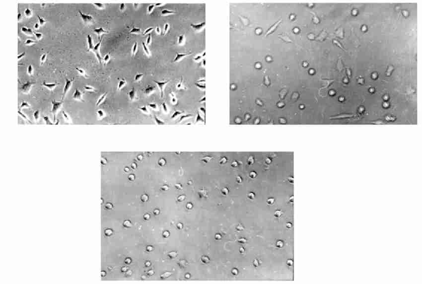 538 20 Fig 6 Growth results of the PC12 cells cultivated with Rab3a and hmt23 proteins (A) Normal growth map of PC12 cells ; (B) Growth of PC12 cells with hmt23 (100 gπml) and AD brain extracts in