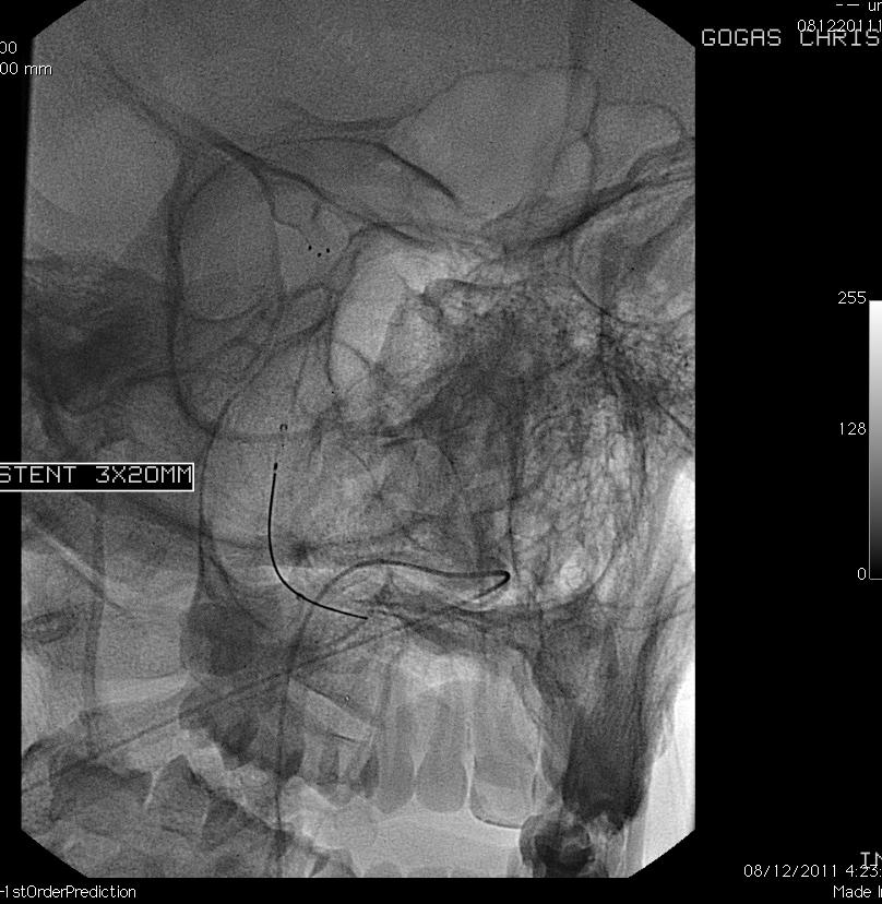 Distal