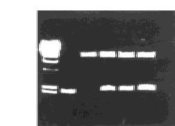 F ig 3 Gel electropho retic analysis of recom binant pvl 1393 H 903 B tk 11ΚDNA digested by H ind g ; 2 61D ifferent recom bi2 nant pvl 1393 H 902 B tk p lasm id DNA digested