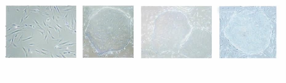 6 (ips ) 515 Table 2 2 RT-PCR The primer for RT-PCR detection of gene expression Germ laye Endoderm Mesoderm Ectoderm Gene AFP Amylase cact Cardiac-actin NFH Sox1 Primer sequence P1: