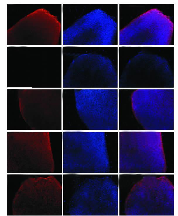 Amylase Cardiac actin Enolase NFH Sox1), CCD-1079SK, (1B-h), CCD-1079SK, ipsc-1 hes 3 (AFP 5D) ( A Octr Octr/ SSEA-1 SSEA-1/ SSEA-4 SSEA-4/ TRA-1-60 TRA-1-60/ TRA-1-81 TRA-1-81/ B 2