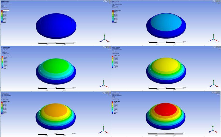 Παραρτήματα A/A Flap Thickness (mm) Flap Radius (mm) IOP (mmhg) Young's Modulus (Mpa) Total Deformation Maximum (mm) Equivalent Stress Maximum (kpa) Equivalent Elastic Strain Maximum 54 0,14 4,5 18