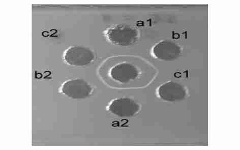 364 24 Fig. 7 The antigen2antibody reaction of a, b, c strip and antiserum The serum antibodies was in the middle well, the concentration of sample a1,b1 and c1 were 1 gπ l, a2,b2 and c2 were 2 gπ l.