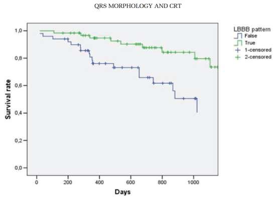 LBBB morphology