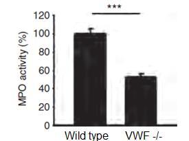 (immune complex-mediated vasculitis) Ερεθιστική εξ