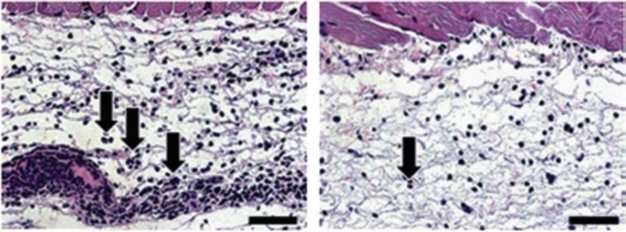 dermatitis) IgG control anti-vwf αντισώματα IgG control anti-vwf αντισώματα