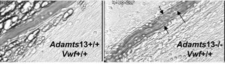 Την αντιφλεγμονώδη δράση της ADAMTS-13 ανταγωνίζονται μικρά πεπτίδια που απελευθερώνονται από τα ουδετερόφιλα (Human Neutrophils Peptides - HNPs ή α-defencins), ενώ η interleukin-6 περιορίζει τη