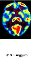 use of rtms for treatment