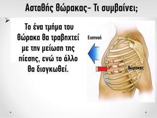 Κακώσεις θώρακα Οι κακώσεις των θωρακικών τοιχωμάτων είναι ιδιαίτερα επικίνδυνες και σημαντικές γιατί εντός του θώρακα υπάρχουν ζωτικά όργανα, υπάρχει δυσκολία στην ακριβή εκτίμηση της έκτασης της