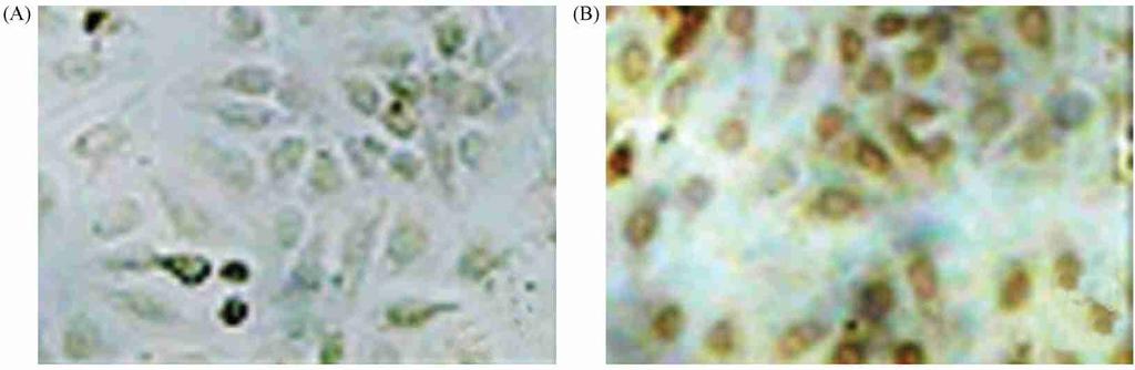 Induced pmal2c 2 2hFDΠBL21 ; 4 : Sedimentation of induced pmal2c 2 2hFDΠBL21 ; 5 : Supernatant of induced pmal2c 2 2hFDΠBL21 ; M: Marker (C) Purified protein in different fractions 1 : Fraction 1