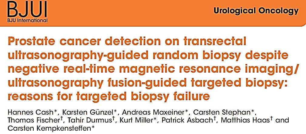 ΑΙΤΙΑ ΑΠΟΤΥΧΙΑΣ ΤΗΣ mpmri FUSION-GUIDED Bx 1.