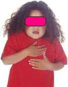 CROUP Ωξ croup ακαθένεηαη ημ θιηκηθό ζύκδνμμμ ημ μπμίμ παναθηενίδεηαη από