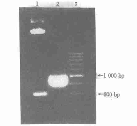 B X bag E corg ; 5. DNA F ig. 3R estriction enzym e digestion of recom binant p lasm id 1. D igestion of clone A w ith B am H g ; 2. D igestion of clone A w ith X bag and E corg ; 3.