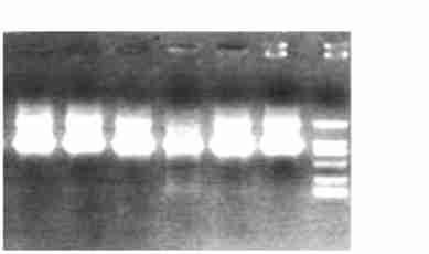 492 18 min F6 + R4 Frag 2(1) Solution 94 5 min, 55 5 min, 72 5 OC16629 ( Ag), HRP2COC16629, (B) PCR (1) PCR F2 + R6 + Frag 2 (1) Solution Frag 2 (2) Solution Solution F5 + R3 + Frag 2(1) Solution
