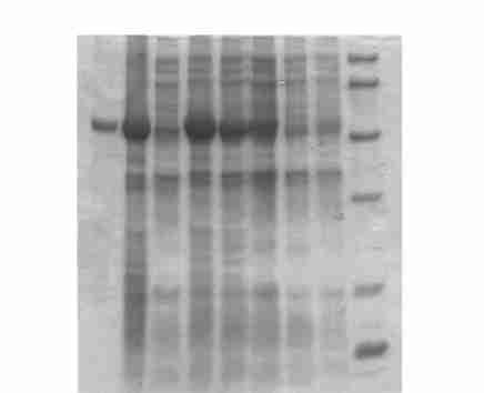 plasmid digested with BamH ΠEcoR (387) ; 7 :Cloned plasmid digested with Sma (1 358 bp) ; 8 :Cloned plasmid digested with EcoR ΠSac (1 136 bp) ; 9 :Molecular weight markers (<X174 DNAΠHae ) ; Fig 4