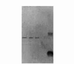 systems showed molecular weight M Protein marker 1,2,3 Renatured fusion protein (1 mgπml) Fig 3 SDS2PAGE analysis of expression and purity of 6B11V L V H hc fusion proteins 1 Renatured fusion protein