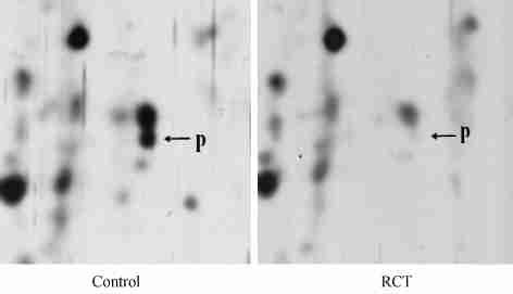 2 : Rg1 MG263 Prohibitin 183 Fig. 2 Enlarged picture of 22D PAGE The spots P which marked with arrows respectively showed the differential expression of prohibitin before and after RCT treatment Fig.