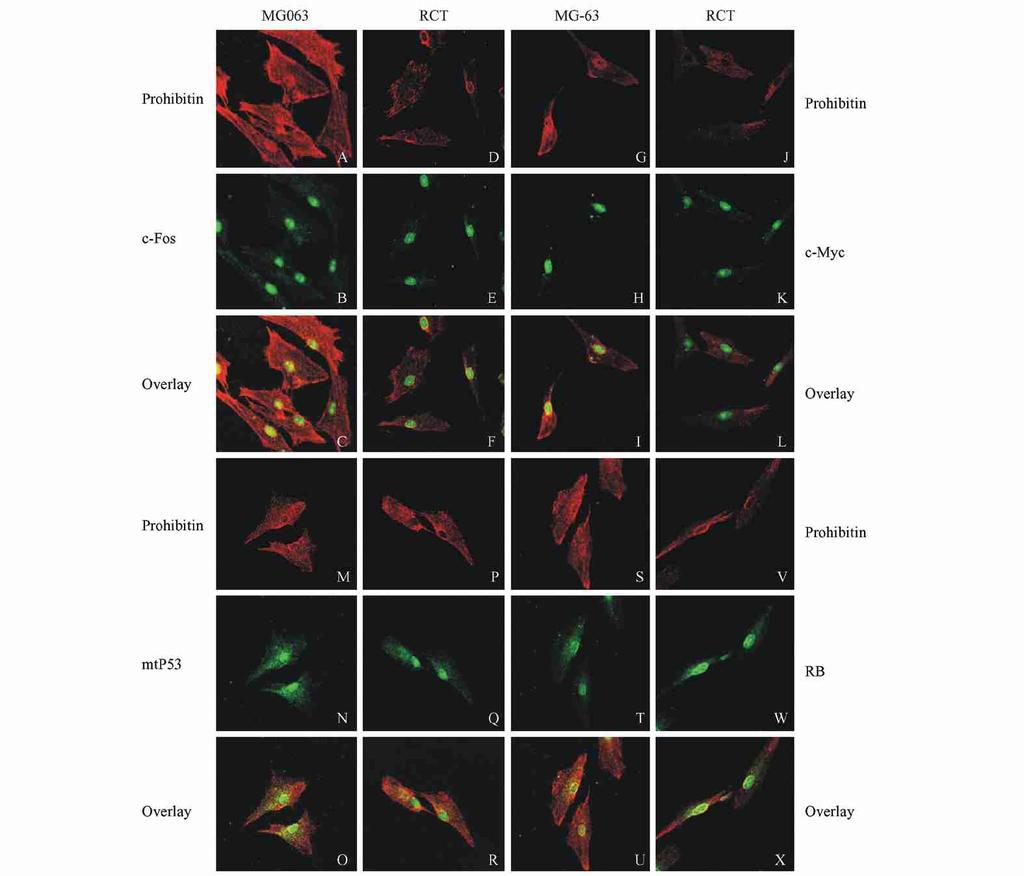 Light microscopy shows the NM2IF system in MG263 cells (CBB stain). (B) Light microscopy shows the NM2IF system in MG263 cells after RCT treatment (CBB stain).
