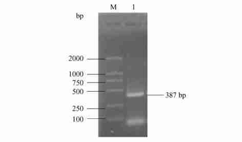 830 24 protein adrenal mrna) 37 481 bp 100 %. 2. 6 GST pull2down 21611 pmd218t2uba52 p GEX24T212UBA52 RNA RT2PCR 252 cdna, 1 DNA, 500 bp 250 bp (Fig. 2, 1), 387 bp.