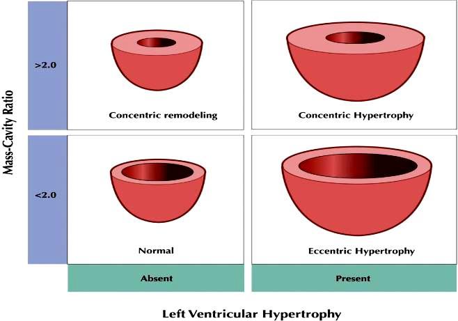 Left ventricular mass and