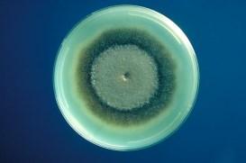 Ουδέτερη α-γλυκοσιδάση Δείγμα 0.5 ml Σπερματικό υγρό (βλ. οδηγία χειρισμού δείγματος και συντήρησης σπερματικού υγρού για βιοχημικούς δείκτες).