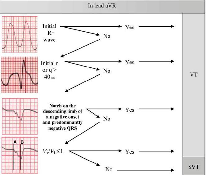 The avr Vereckei algorithm Vereckei