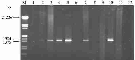 RNA,, (50mgΠmL),37 1h, 15min 1 DNA 100 L SDS ( 10 %), 1210 L K,,, (20mgΠmL),37 1h PCR (24 1 ),14000 g 15min,,, 115mL 2-20 14000 g 15min,, 70 % 100 L TE (10mmolΠL,pH810), - 20 113 16S rrna PCR PCR 50