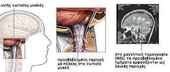 Διάγνωση Κεντρικό ρόλο έχει η