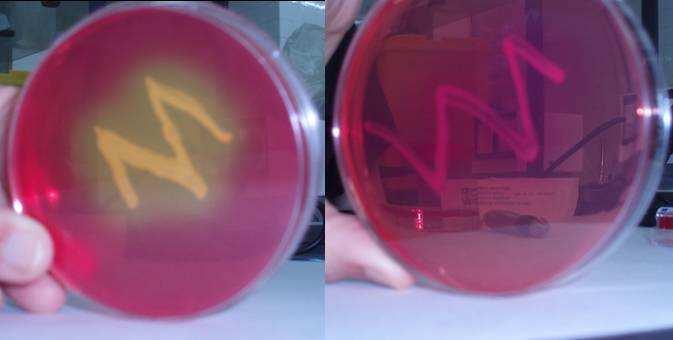 Manitol gazidun agarraren irakurketa. Staphylococcus generoko bakterioak soilik haziko dira agar horretan, gatz-kontzentrazioa dela eta.