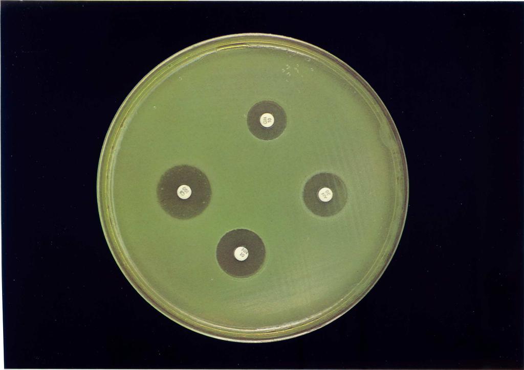 10.1 irudia. Antibiograma agarrean. 5. Antibiograma interpretatu, antibiotiko bakoitzaren hazkuntzaren inhibizioa eragiteko gutxieneko kontzentrazio-puntuari dagokion diametroarekin alderatuz.